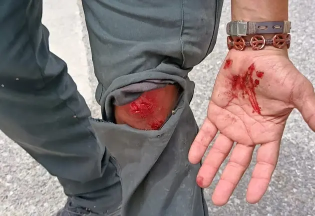 guardia civil herido