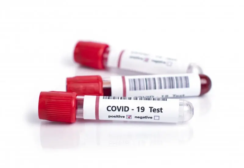 covid_19_test