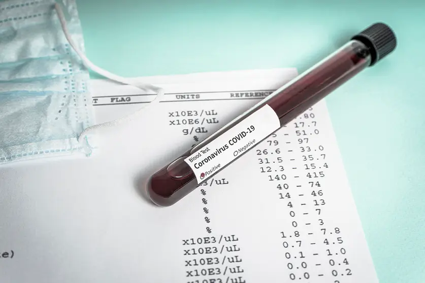 Hand holds a test tube containing a blood sample, test tube  for Covid-19 (coronavirus) analyzing. Laboratory testing patient’s sample