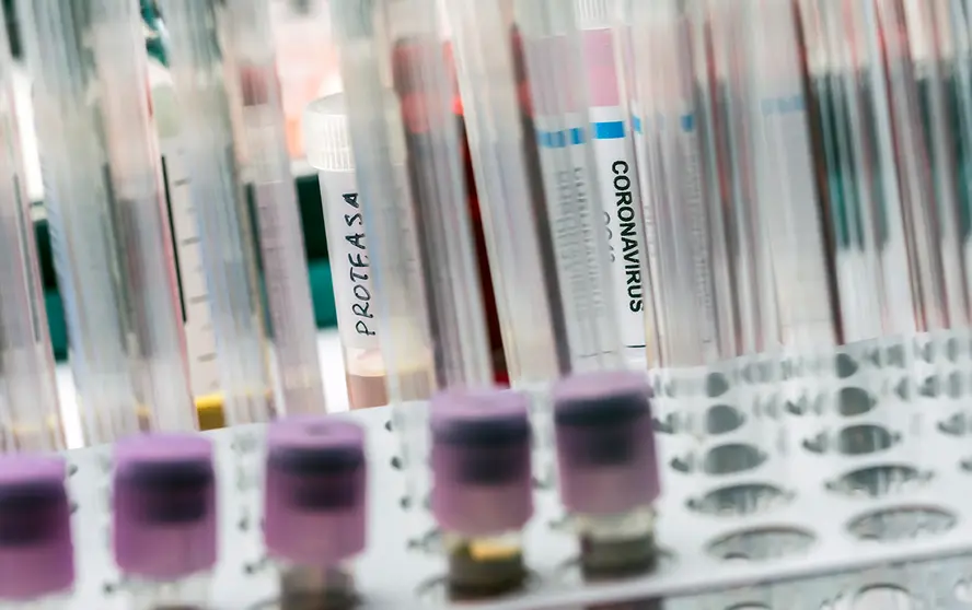 Vial pcr of SarsCov2 coronavirus, conceptual image