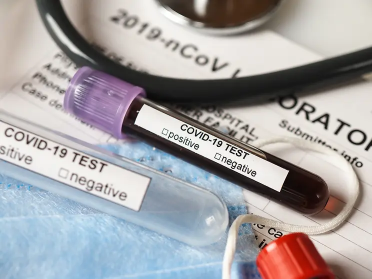 Coronavirus COVID-2019 test concept with blood test tubes, test form and other medical objects