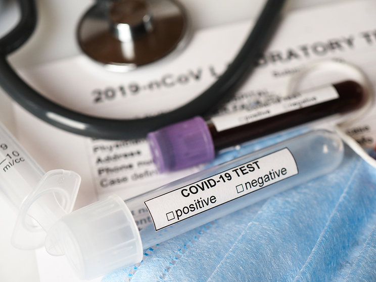 Coronavirus COVID-2019 test concept with blood test tubes, test form and other medical objects