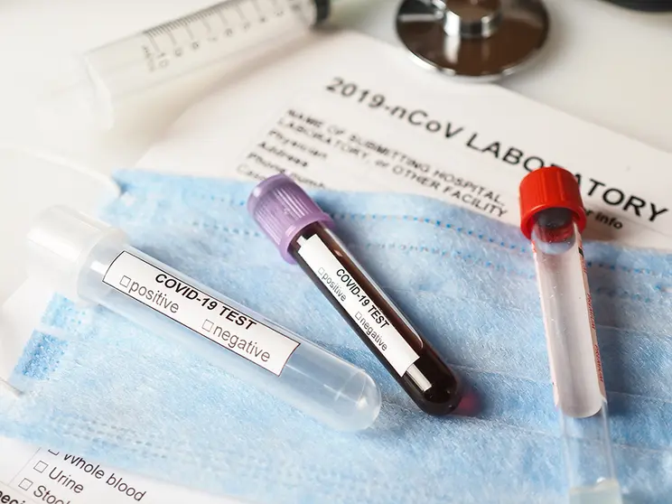 Coronavirus COVID-2019 test concept with blood test tubes, test form and other medical objects