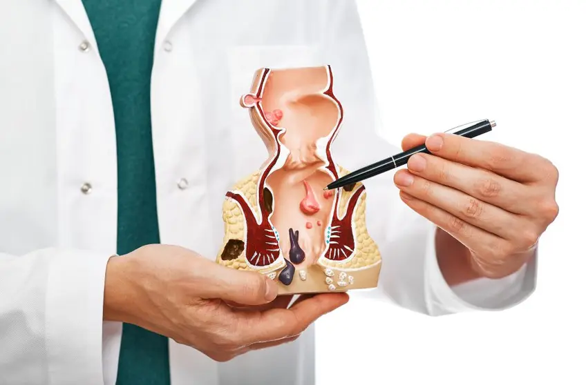 cribado colon cáncer colorrectal