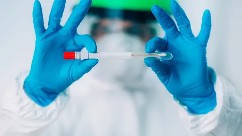 Corona virus test kit - Swab sample for PCR DNA testing 