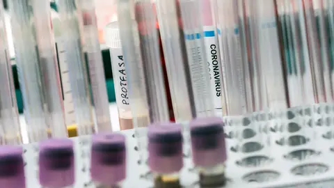 Vial pcr of SarsCov2 coronavirus, conceptual image