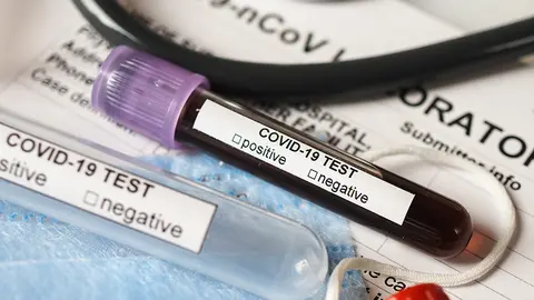 Coronavirus COVID-2019 test concept with blood test tubes, test form and other medical objects