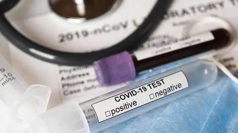 Coronavirus COVID-2019 test concept with blood test tubes, test form and other medical objects