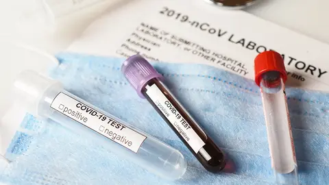 Coronavirus COVID-2019 test concept with blood test tubes, test form and other medical objects