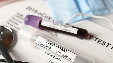 Coronavirus COVID-2019 test concept with blood test tubes, test form and other medical objects