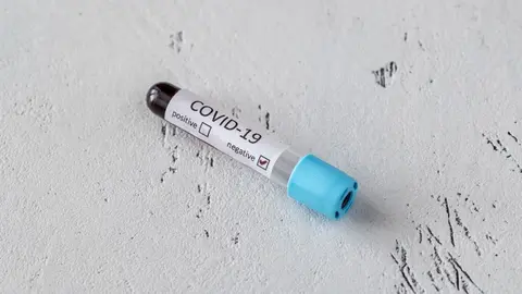 coronavirus-testing-3MBAU6S