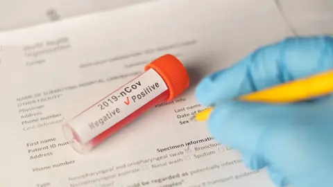 coronavirus-is-documented-YVVJ63X