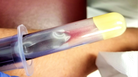 may-18th-is-national-hiv-vaccine-awareness-day-to-2022-08-01-01-22-37-utc