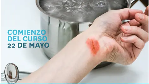 230502-accidentes en el hogar-01