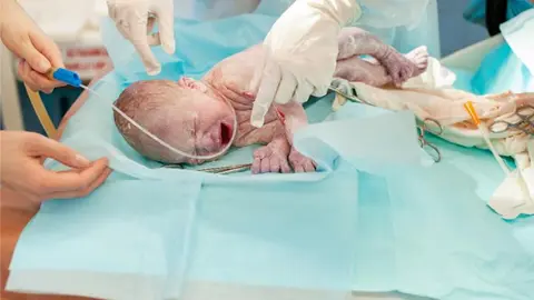 MATRONA RECIEN NACIDO