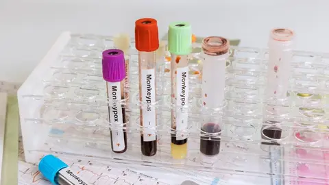 TUBOS CON MUESTRAS LABORATORIO