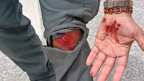 guardia civil herido