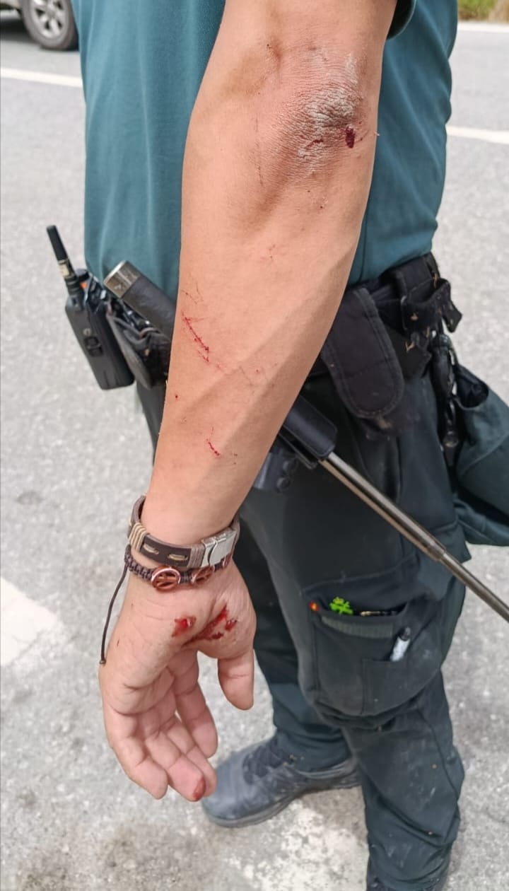guardia civil herido